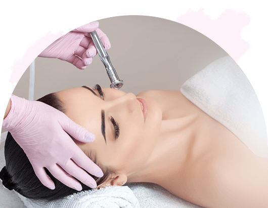Microdermabrasie dronten