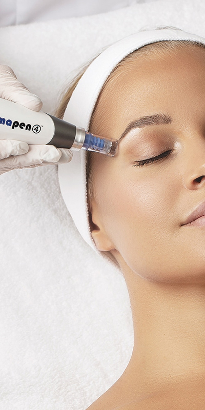 Dermapen-Schoonheidssalon-Dronten_02